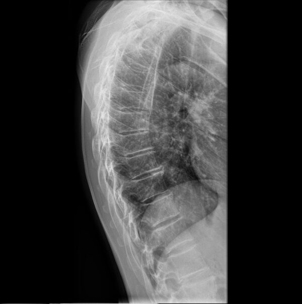 MUSICA™ - Image Processing Software for Digital Radiography