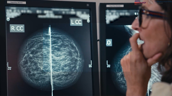 How our 24M detector enhances Image clarity and patient care